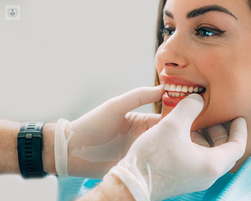 Estética Dental para lucir sonrisa