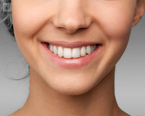 ¿Cómo mantener los dientes blancos?
