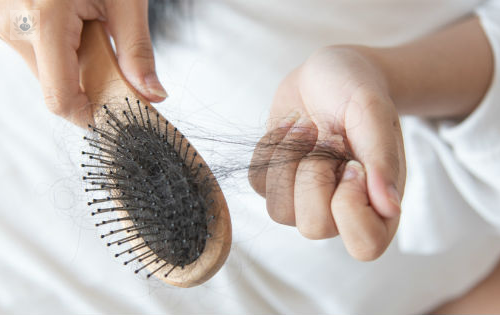 la-caida-del-cabello-que-tratamientos-existen imagen de artículo