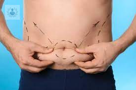 liposuccion-cirugia-para-eliminar-la-grasa-corporal imagen de artículo