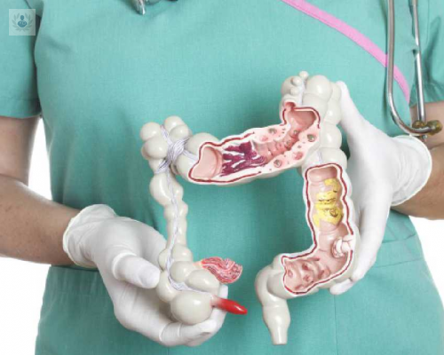 que-es-el-sindrome-de-colon-irritable-y-como-nos-afecta imagen de artículo