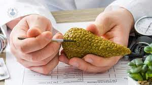 que-es-el-cancer-de-pancreas imagen de artículo