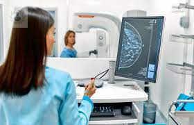 mamografia-tecnologia-de-punta-para-la-deteccion-del-cancer-de-mama imagen de artículo