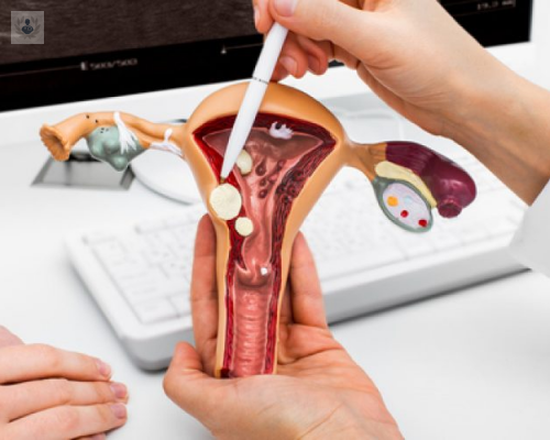 miomas-uterinos-tumores-benignos-de-alta-frecuencia imagen de artículo