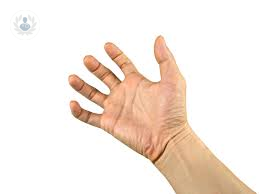 distonias-tipos-tratamientos-y-causas imagen de artículo