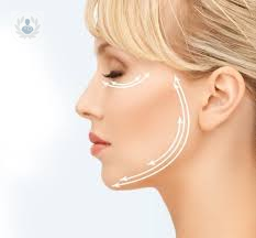 ritidoplastia-cervicofacial-ritidectomia-lifting-o-estiramiento-facial imagen de artículo