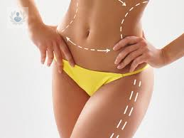 liposuccion-lipoescultura-y-abdominoplastia-en-que-consisten imagen de artículo