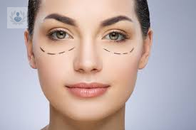 cirugia-estetica-para-los-parpados-caidos-p1 imagen de artículo