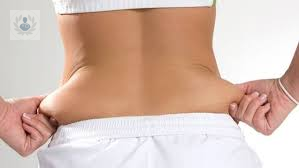 Abdominoplastia: ideal para eliminar grasa, estrías y cicatrices
