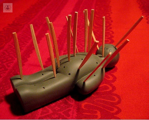 acupuntura-el-arte-de-la-energia-en-movimiento imagen de artículo