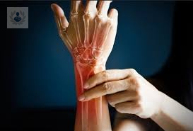 artroscopia-de-muneca imagen de artículo