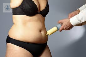 liposuccion-como-lograr-un-cuerpo-bonito-y-armonico-p1 imagen de artículo