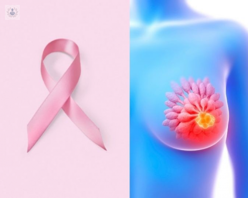 deteccion-oportuna-del-cancer-de-mama-conoce-todos-los-detalles-p1 imagen de artículo