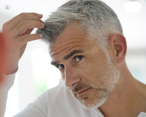 Caída de cabello exagerada o Alopecia: causas y tratamiento (P2)