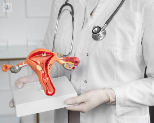 cirugia-de-utero-procedimiento-necesario-para-la-miomatosis imagen de artículo