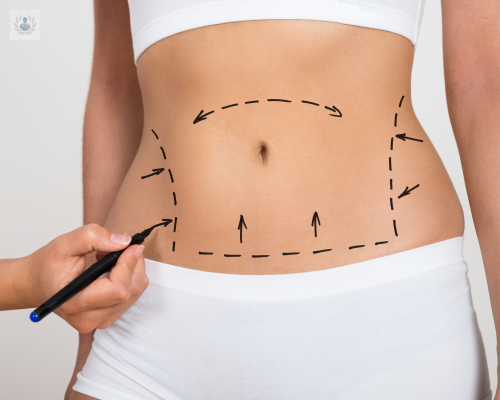 titulo-liposuccion-como-lograr-un-cuerpo-bonito-y-armonico-p4 imagen de artículo