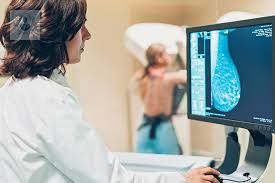 sintomas-de-cancer-de-mama-principales-senales-y-diagnostico-p1 imagen de artículo