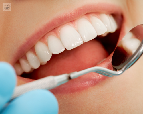 Todo sobre Implantes Dentales y Estética Dental (P1)