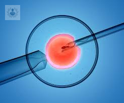 tratamiento-de-fertilidad-in-vitro-cual-es-el-primer-paso-p1 imagen de artículo
