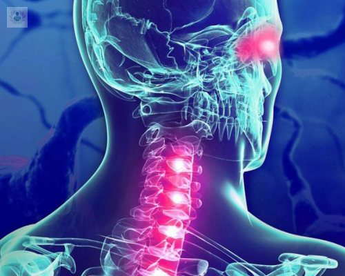 neuromielitis-sintomas-y-diagnostico imagen de artículo