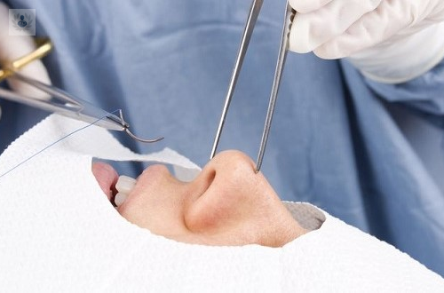 rinoplastia-procedimiento-y-cuidados imagen de artículo