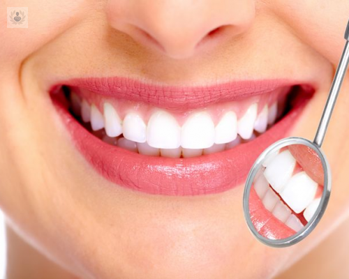 en-que-consiste-un-diseno-de-sonrisa imagen de artículo