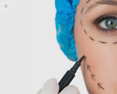 recomendaciones-para-antes-de-realizarse-una-cirugia-estetica imagen de artículo