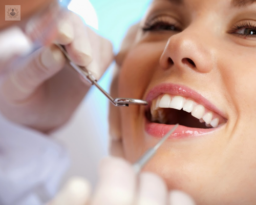 implantes-dentales-tipos-y-proceso-de-colocacion imagen de artículo