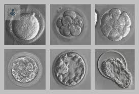 tratamiento-de-fertilidad-in-vitro-cual-es-el-primer-paso-p3 imagen de artículo