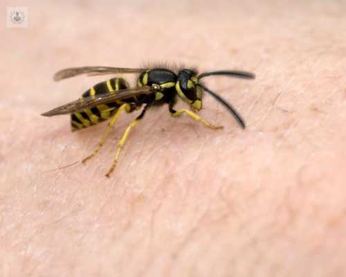 inmunoterapia-con-veneno-abejas-y-avispas imagen de artículo