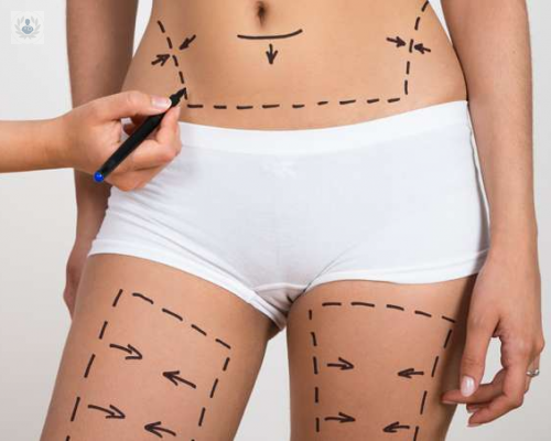 tres-consejos-que-te-haran-sentir-mejor-despues-de-una-cirugia-de-contorno-corporal imagen de artículo