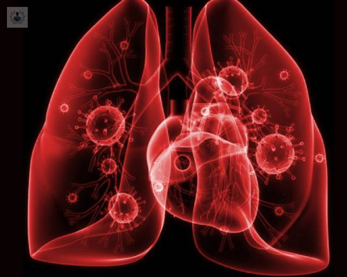neumonia-atipica-como-diferenciarla-de-la-neumonia-normal imagen de artículo