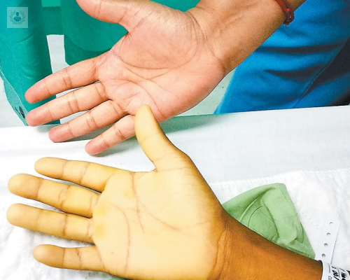tipos-de-anemia-y-sus-causas imagen de artículo