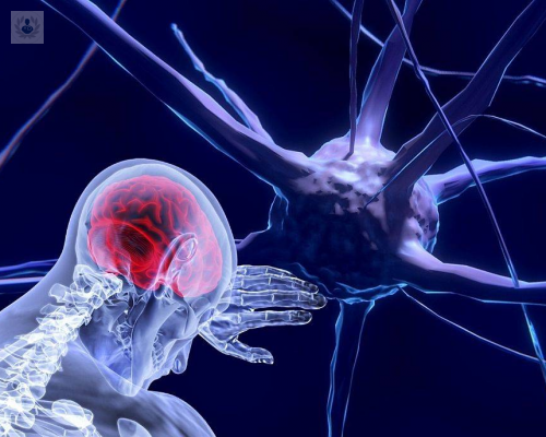 todos-los-tumores-cerebrales-son-iguales-conoce-todos-los-detalles imagen de artículo