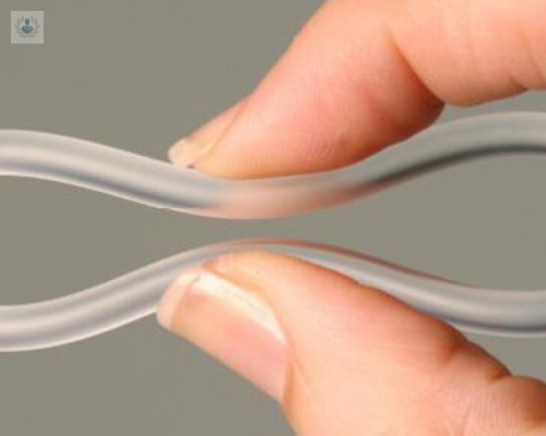 anillo-anticonceptivo-cuales-son-sus-ventajas imagen de artículo