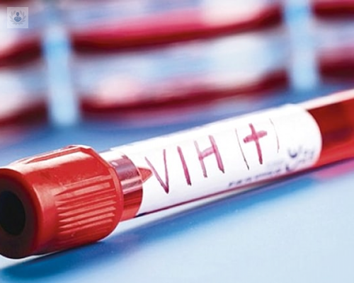 Hay un nuevo caso registrado de remisión del VIH, es el segundo