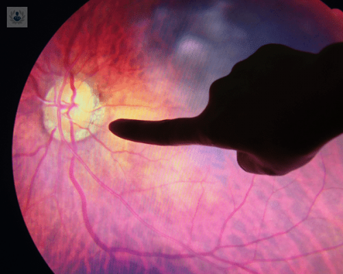 la-diabetes-afecta-la-vision-mito-o-realidad imagen de artículo