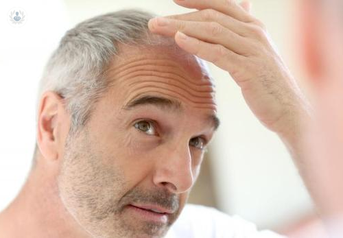 trasplante-de-pelo-como-se-realiza-y-de-donde-se-toman-los-injertos imagen de artículo