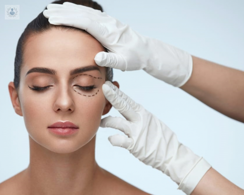 consigue-una-mirada-mas-joven-con-la-blefaroplastia imagen de artículo