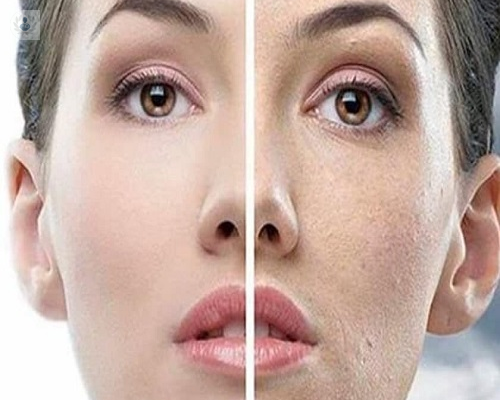 como-evitar-el-envejecimiento-prematuro-de-la-piel imagen de artículo