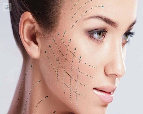 hilos-tensores-una-alternativa-minimamente-invasiva-para-rejuvenecer imagen de artículo