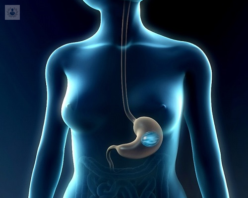 balon-intragastrico-que-ventajas-tiene-y-en-que-consiste-el-procedimiento imagen de artículo