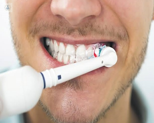 Un buen cepillado dental ayuda a prevenir enfermedades como la Gingivitis y las Caries
