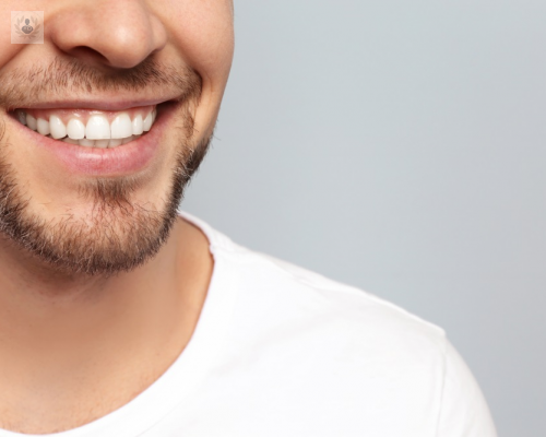 ¿Qué son los Implantes Dentales? Averigua los detalles
