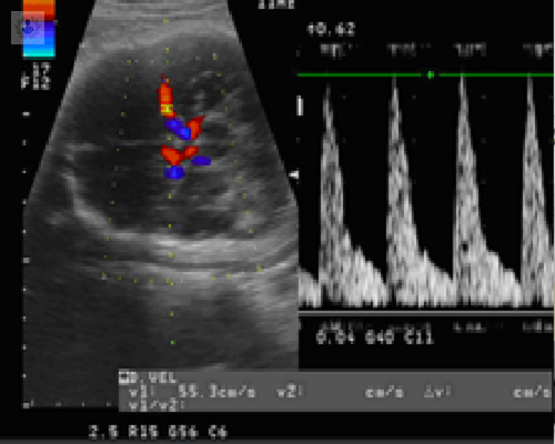como-ayuda-la-ecografia-durante-el-embarazo imagen de artículo