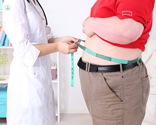 cirugia-de-la-obesidad-cuales-son-sus-caracteristicas-y-resultados imagen de artículo