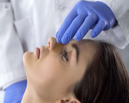 rinoplastia-estetica-y-funcional-cuando-son-necesarias imagen de artículo