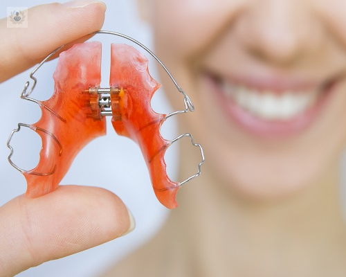 ortopedia-maxilar-que-es-y-para-que-sirve imagen de artículo