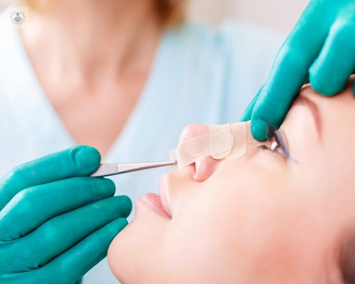 rinoplastia-todo-lo-que-necesita-saber imagen de artículo