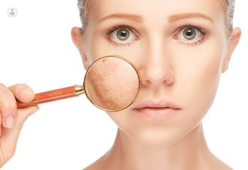 que-efectos-puede-causar-el-sol-en-la-piel-averigua-los-detalles imagen de artículo